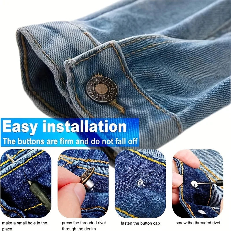 No-Sew Button Repair Kit